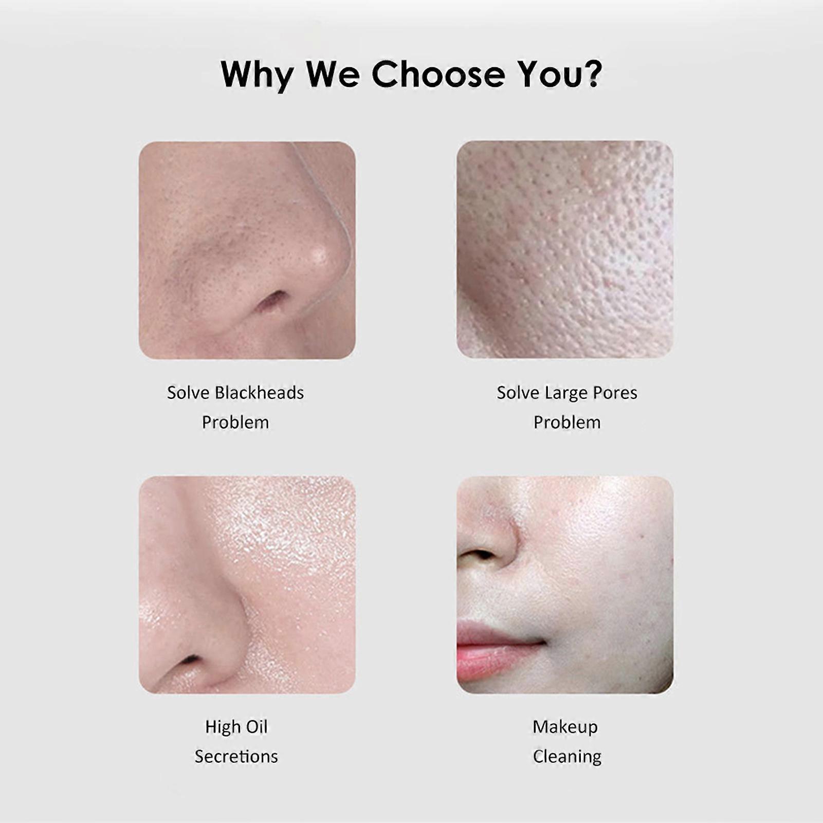 Vibrate Deep Face Cleaning Device Skin Scrubber Face Lifting Peeling Cleaner