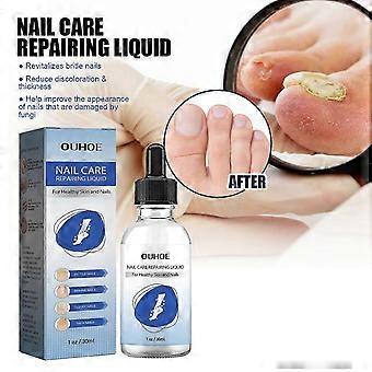 Revitalizing Nail Repair Serum with Vitamin E & Ginseng  Strengthen, Brighten & Rejuvenate Fragile, Discolored Nails | Fungal & Damage Treatment with