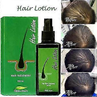 Green Wealth Growth Hair Lotion 120ml - Supports Healthy Hair Development and Growth Against Loss_cdb2