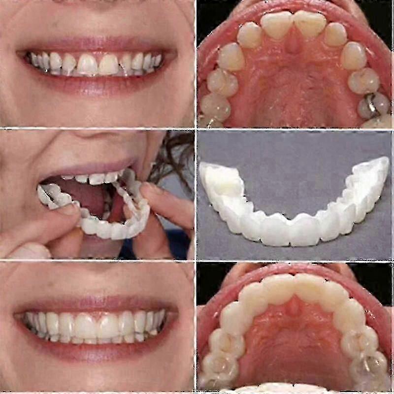 Reusable Denture Braces with No Drilling Required Temporary Fake Teeth Veneers Snap On Instant Solution