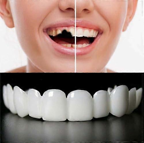 Temporary Veneers for Missing Teeth Adjustable Comfortable Fit Instant Smile Fake Teeth Cover
