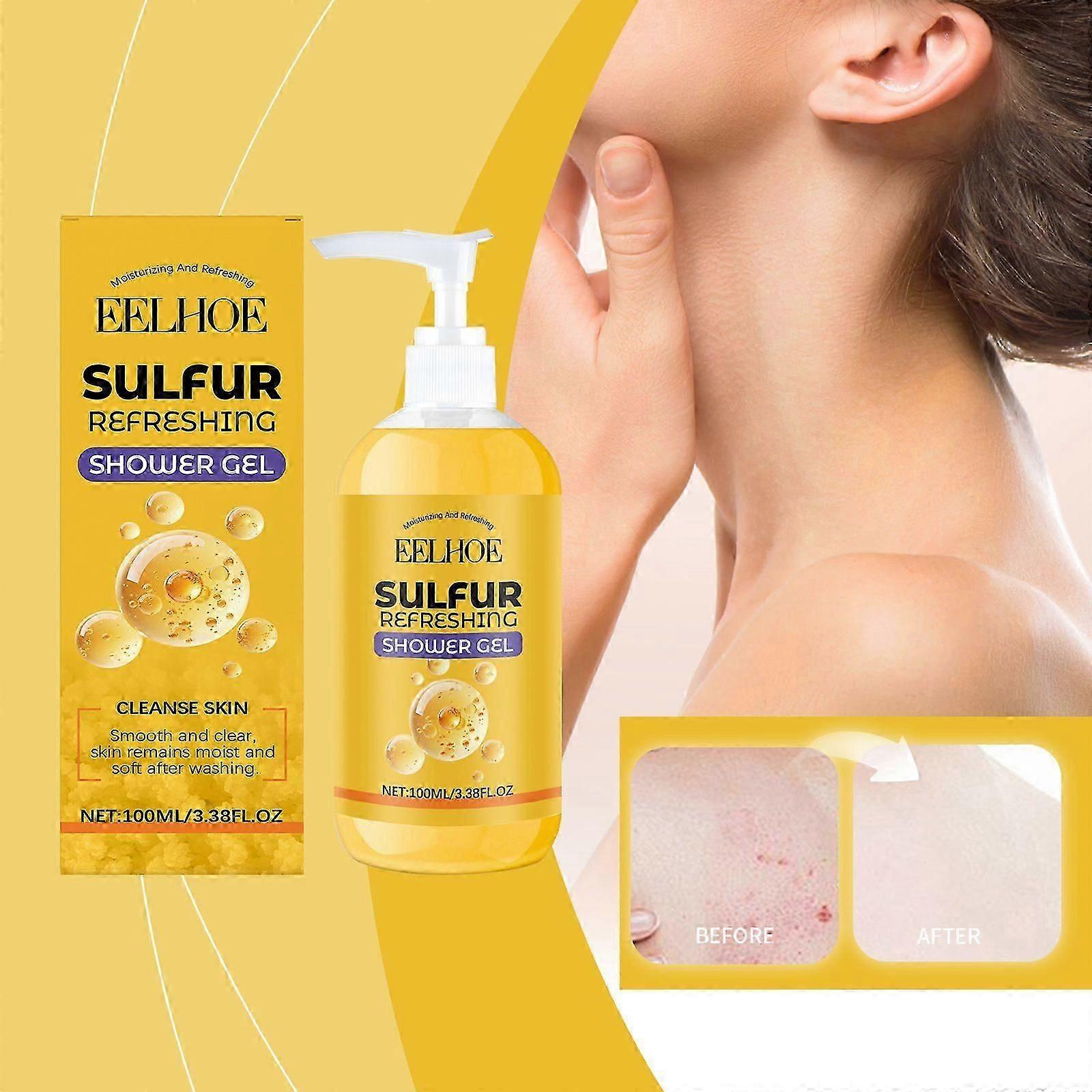 جل الاستحمام المنعش بالكبريت ضد رائحة الجسم وحب الشباب، تركيبة الكبريت المضادة للبكتيريا مع التنظيف العميق للبشرة الحساسة، درجة الحموضة المحايدة والنباتية، الفقرة