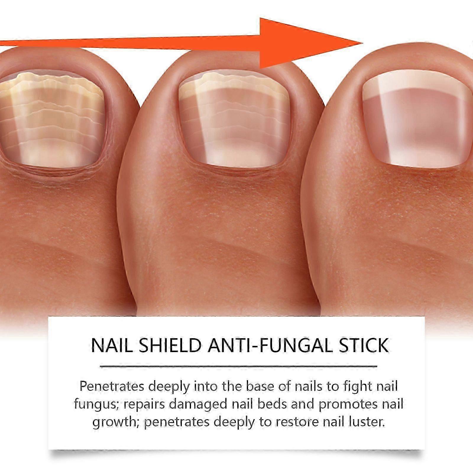Amz Nail Care Roller Stick