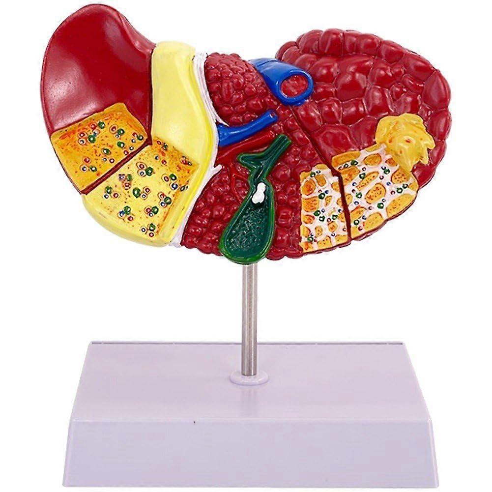 Anatomical Model of the Pathological Liver 1:1 Scale Human Liver for Medical Study and Research in Education
