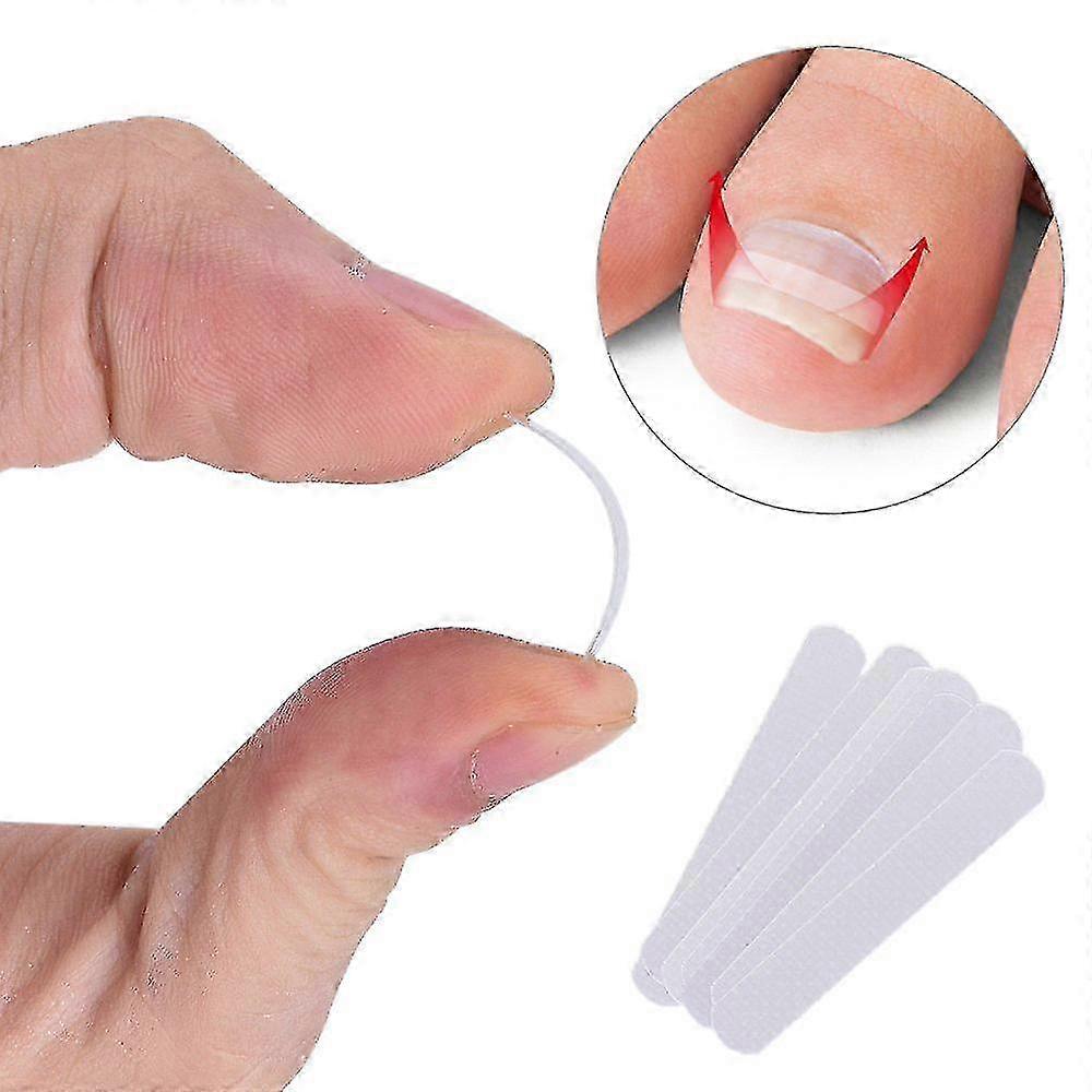 Ingrown Toenail Πεντικιούρ Tool 10pcs/bottle Κλιπ Ισιώματος Κυρτό Bs Brace Toenails Thick Paronychia Εργαλείο Διόρθωσης Foot f74