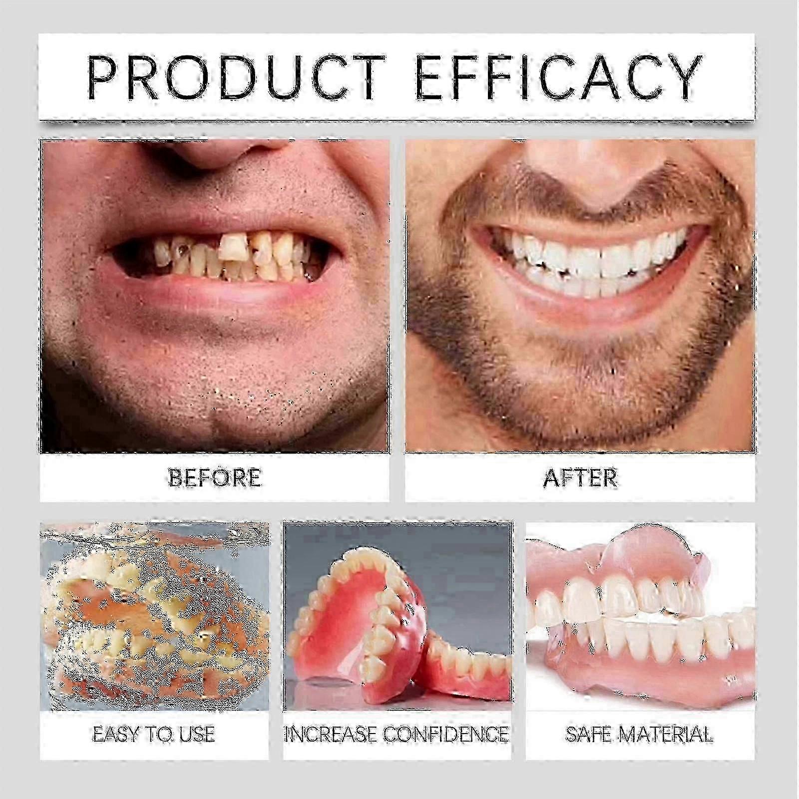 Premium Full Denture Set - Upper & Lower False Teeth Solution for Men and Women