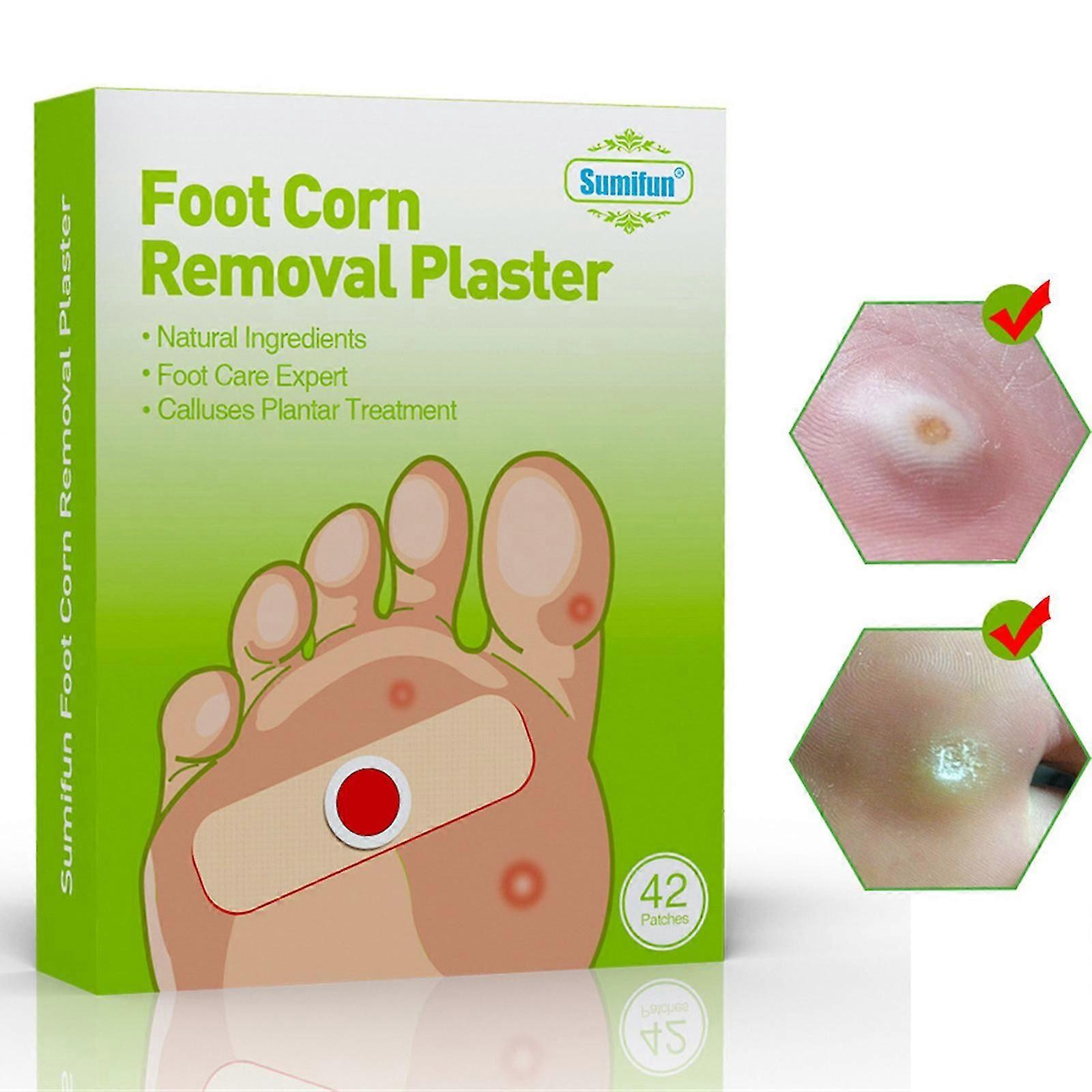 Paste Removes Corns, Blisters, And Feet Corns Removal