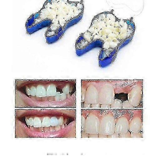 Temporary Denture Braces Occlude Upper Dentures Veneer Dentures Missing Teeth FASTXM