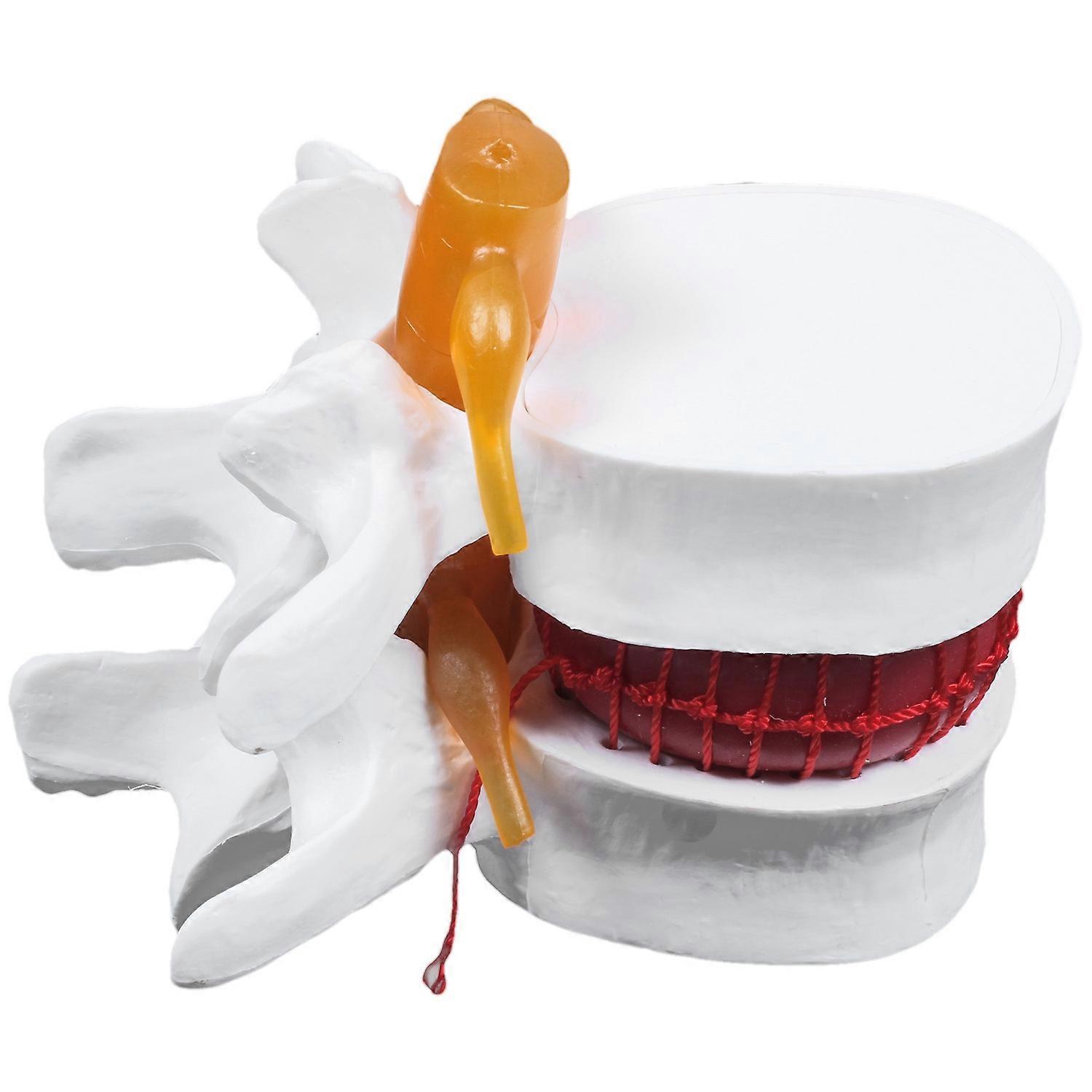 Human Anatomy Skeleton Spine Lumbar Disc Herniation Teaching Model Brain Skull Traumatic School Sup