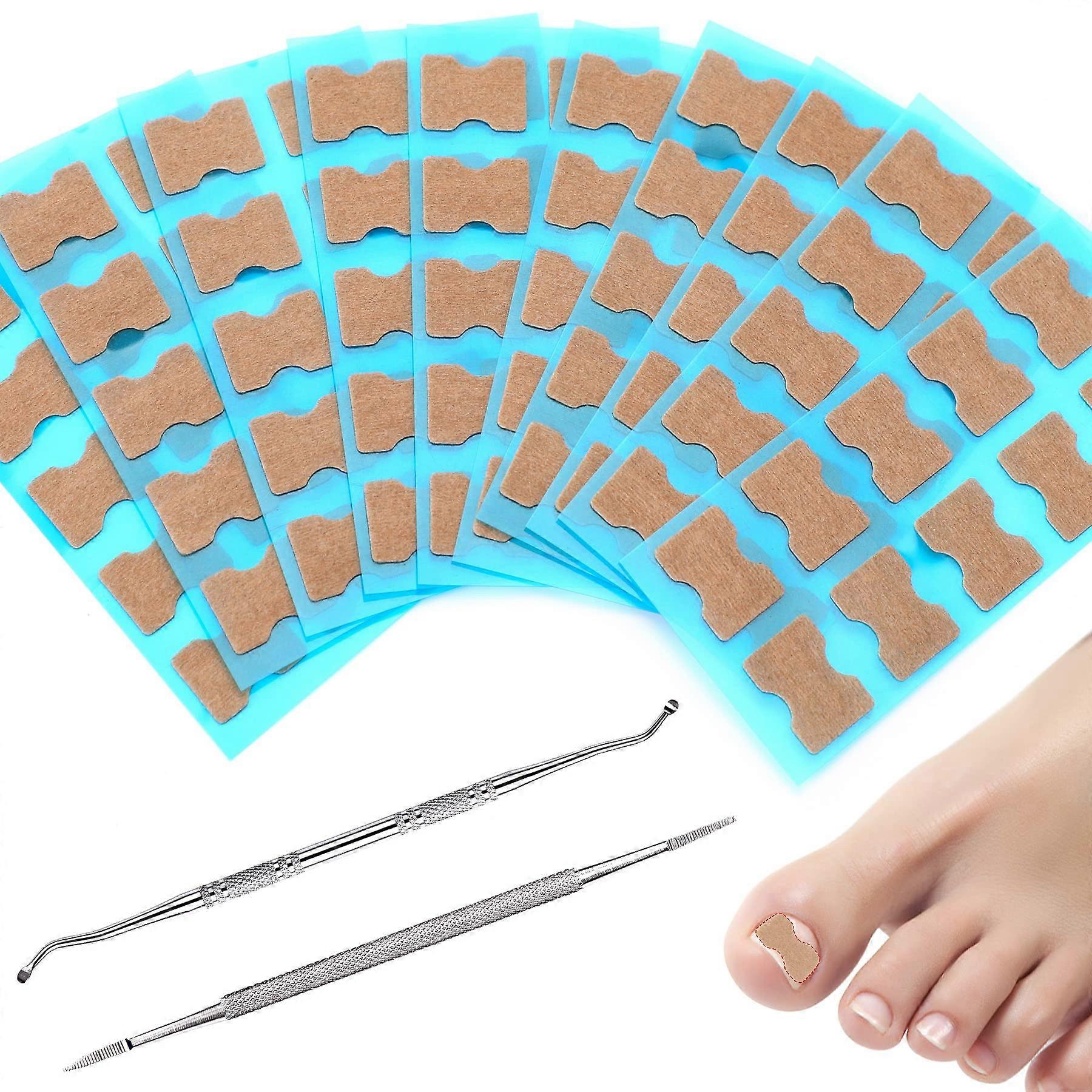 100 Pieces Ingrown Toenail Tool Set with 2 Corner Lifters, Foot Care, Toenail Correction, Correction Plasters for Nail Care