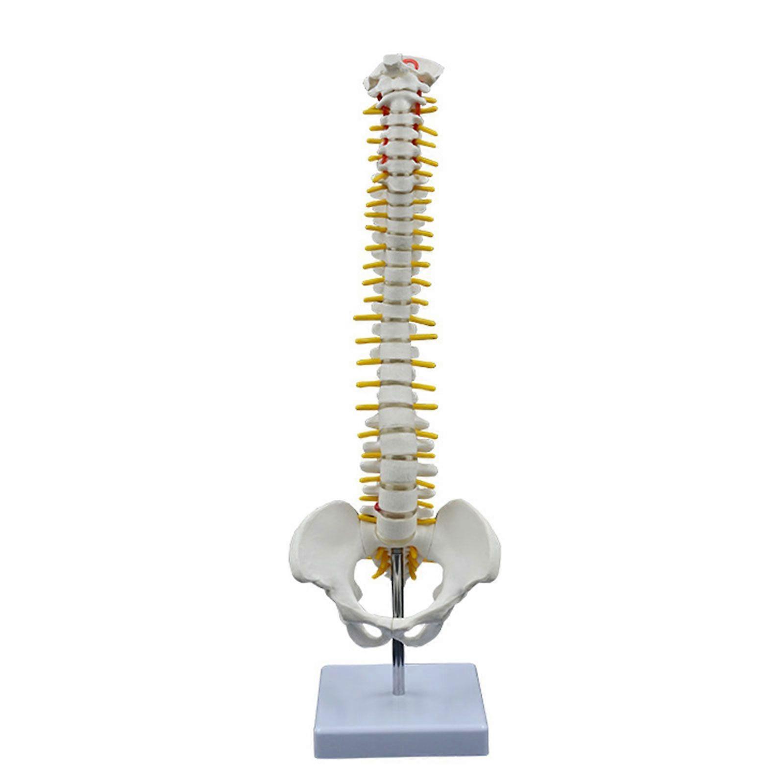 Human Spine Bone Model Shows Herniated Disk Pelvis Femur with Display Stand