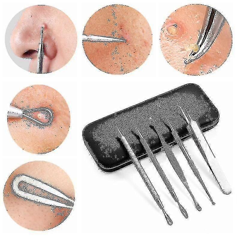Blackhead Set Acne Removal Tool Acne Set With Mirror