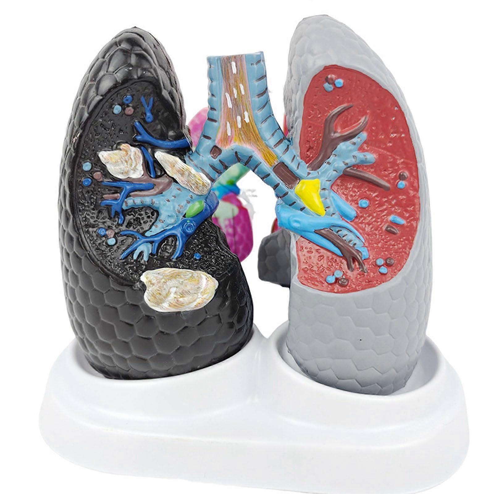 Anatomical Lung Model with Clear Detail, ColorCoded PVC Human Respiratory System Teaching Aid
