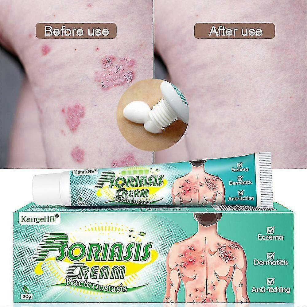 1/2pcs Skin Ringworm Anti-itng Cream Dermatitis Eczema Psoriasis And 20g