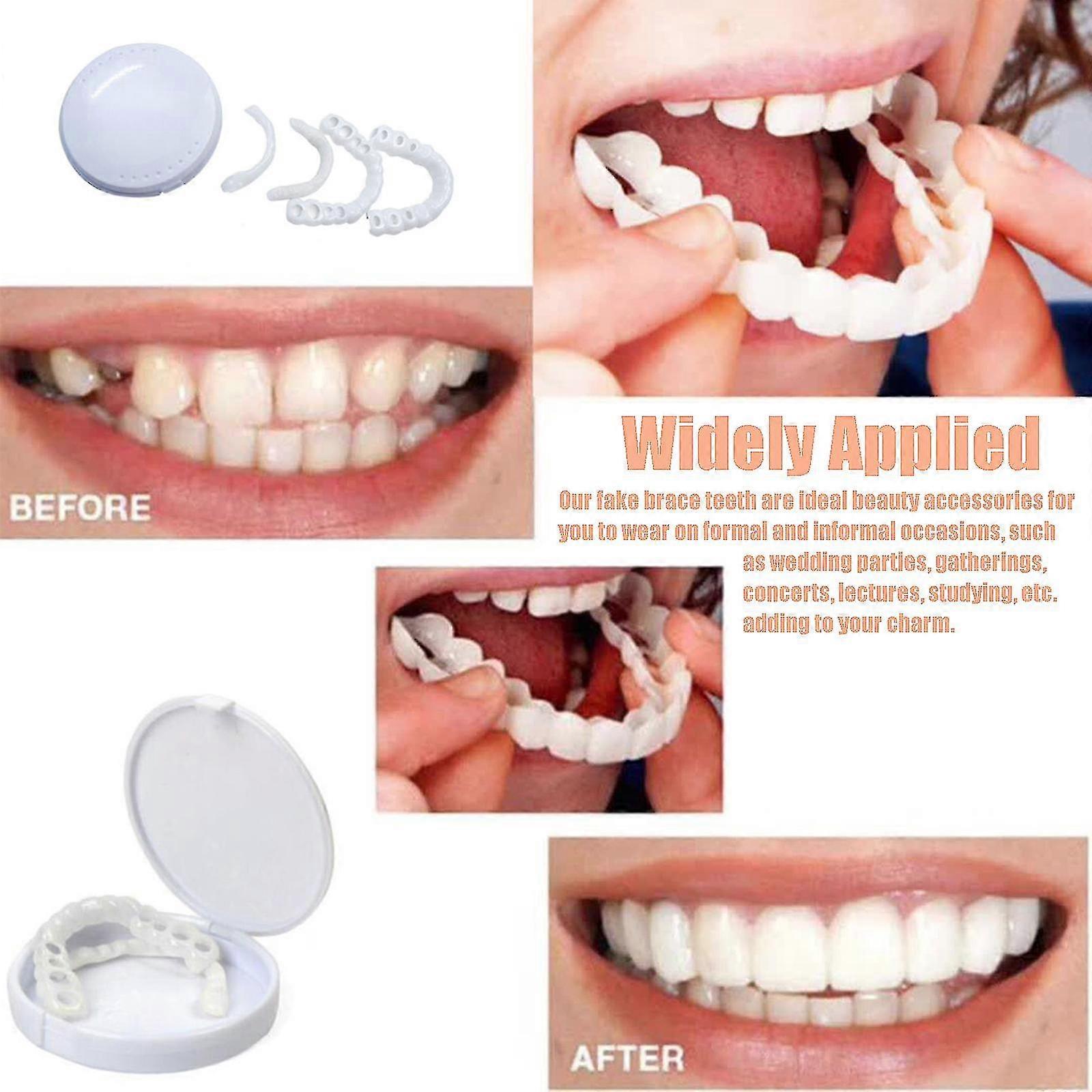 New Snap On Teeth Veneers,perfect Teeth Temporary Replacement,healthy Creative Smiling Veneers（white)