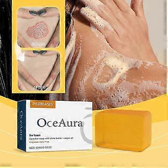 Bee Venom Psoriasis Treatment Soap, Bee Venom Psoriasis Care Bar Soap, Bee Venom Care Bar Soap with Shea Butter & Argan Oil