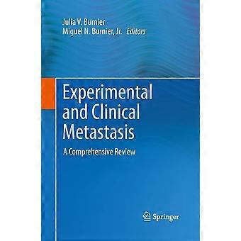 Experimental and clinical metastasis a comprehensive review