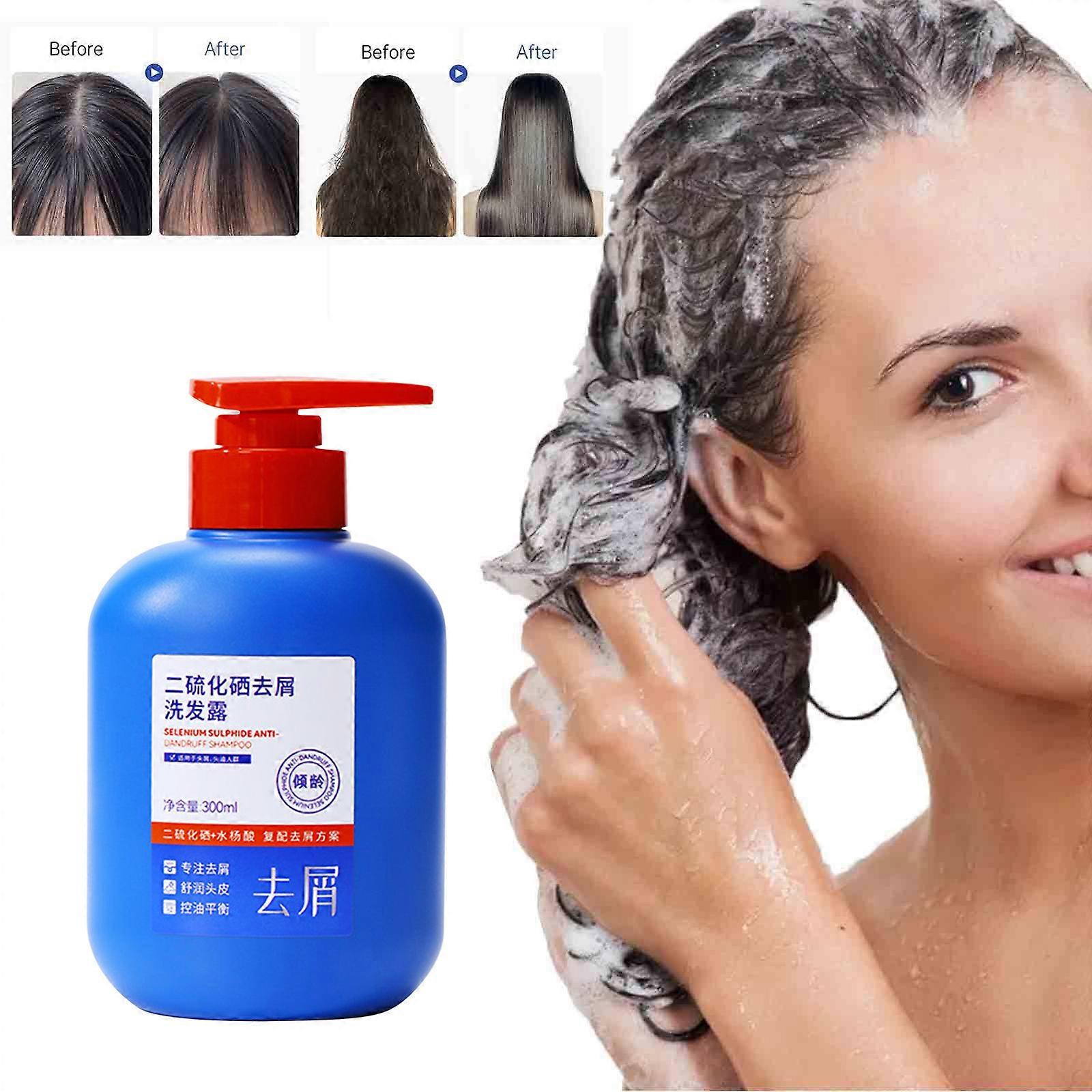 300ml Selenium Disulfide Suntan And Dandruff Removing Shampoo, Refreshing, Soft, Manic And Moisturizing Shampoo