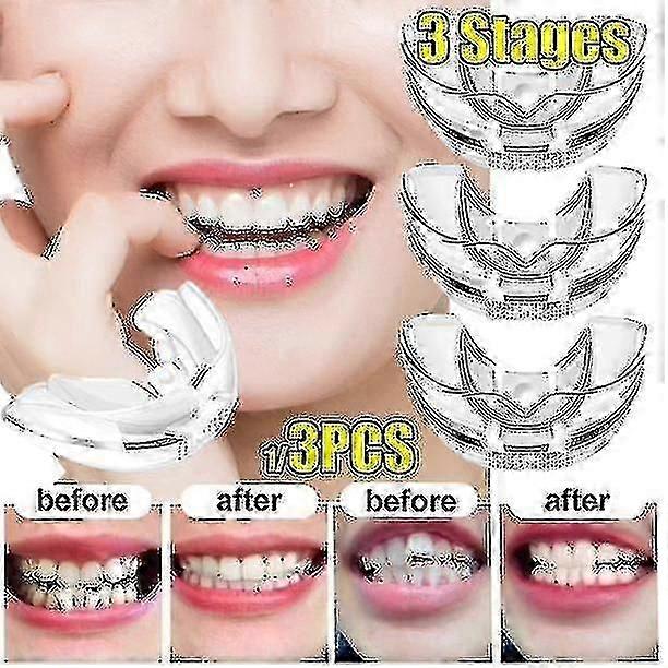 Mouth Guard,braces Invisible 3 Stages Tooth Appliance Aligners Trays Teeth Straightener Retainer Alignment Trainer Mouth