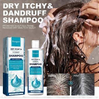 Shampoo for seborrhoeic dermatitis scalp psoriasis folliculitis dry itchy oily scalp 100ml