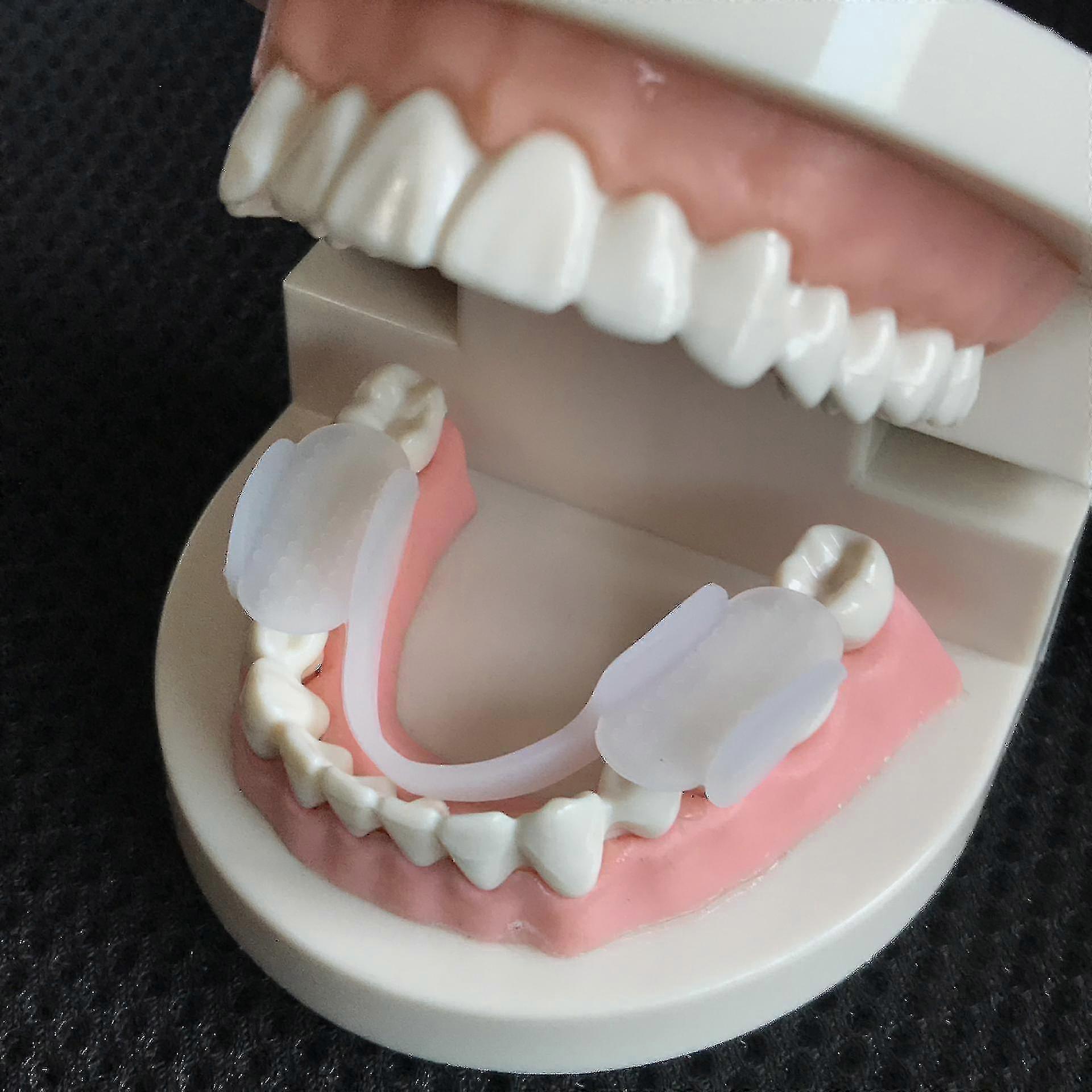 Bruxism Προστατευτικό Στόματος Νάρθηκα Νάρθηκα Νάρθηκα Σύσφιξης Οδοντικά Σιδεράκια Εκπαιδευτής Ευθυγράμμισης Ενίσχυση Ύπνου Προστατευτικά Δόντια Εργαλεία Ls
