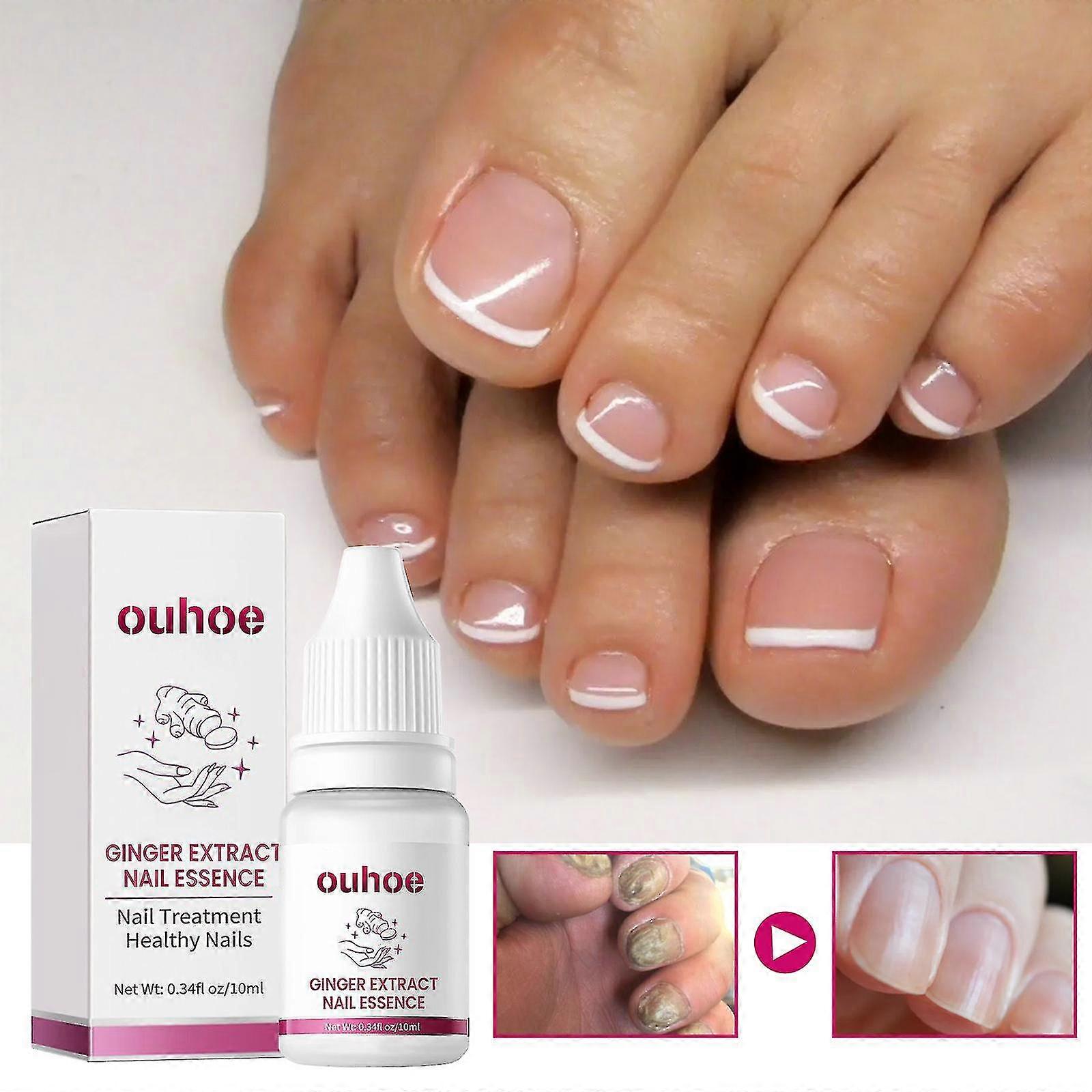 Ginger Nail Care Essence Natural Extract