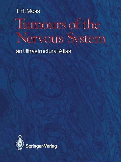 Tumours Of The Nervous System by Timothy H. Moss Paperback