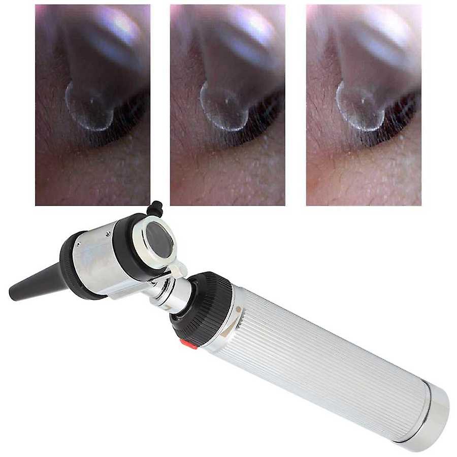 Tomografia Ottica: Esame OCT All’occhio - In Cosa Consiste - Foto 8