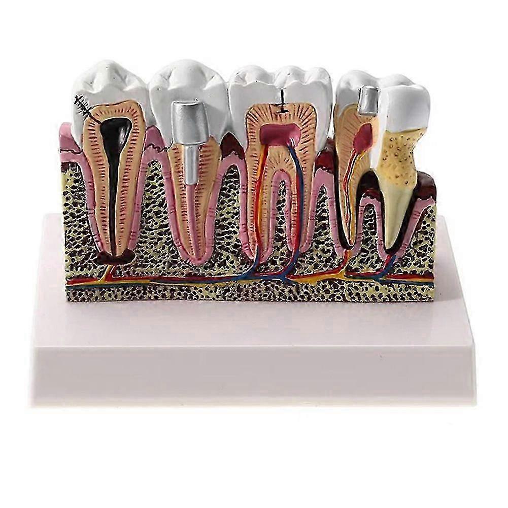 Standard Dental Oral Teeth Anatomical Teaching Model Comprehensive Tooth Structure Model Dentist Dental Demonstration