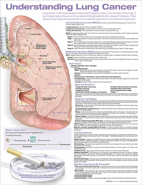 Understanding Lung Cancer Anatomical Chart Wallchart Book