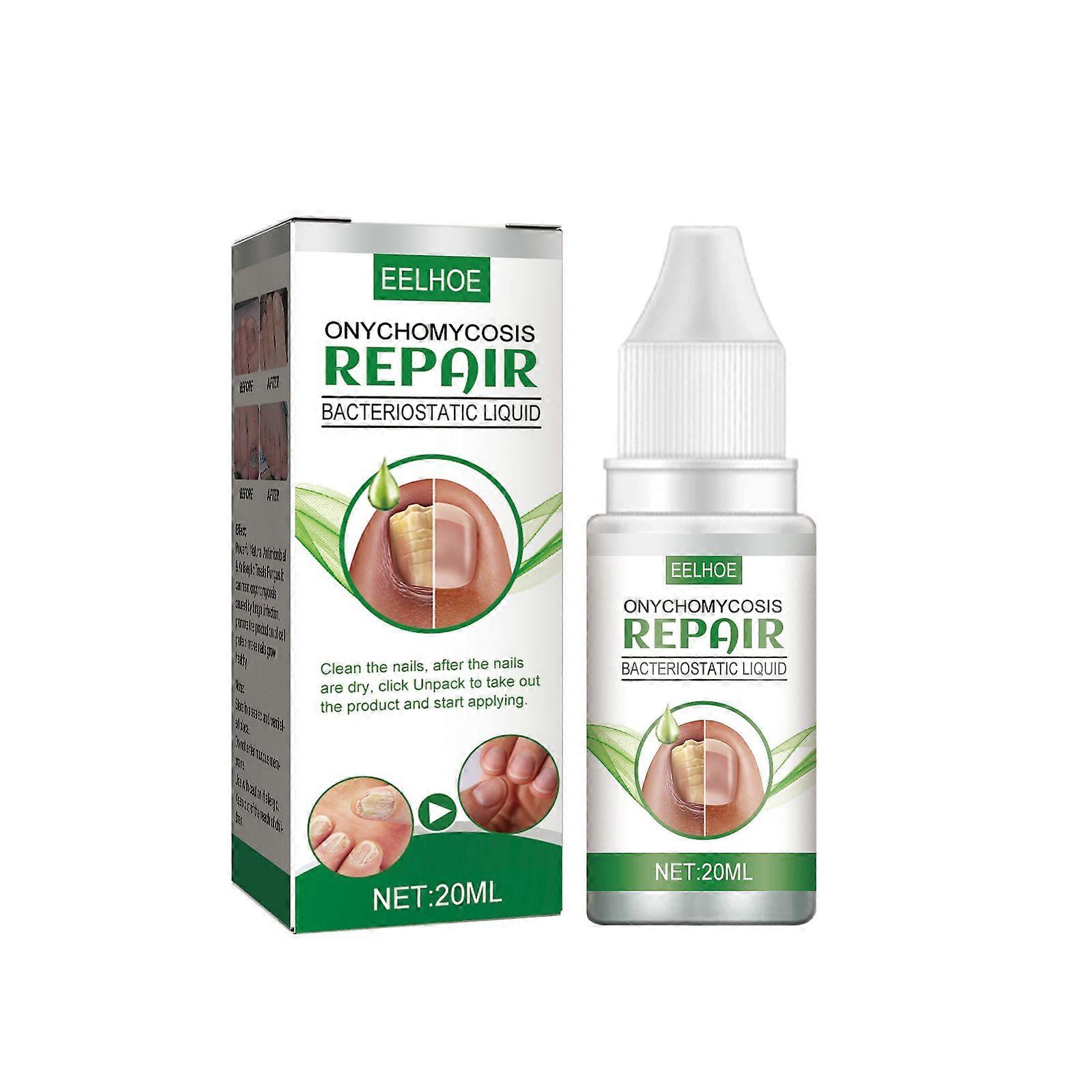 Onychomycosis Repair Liquid