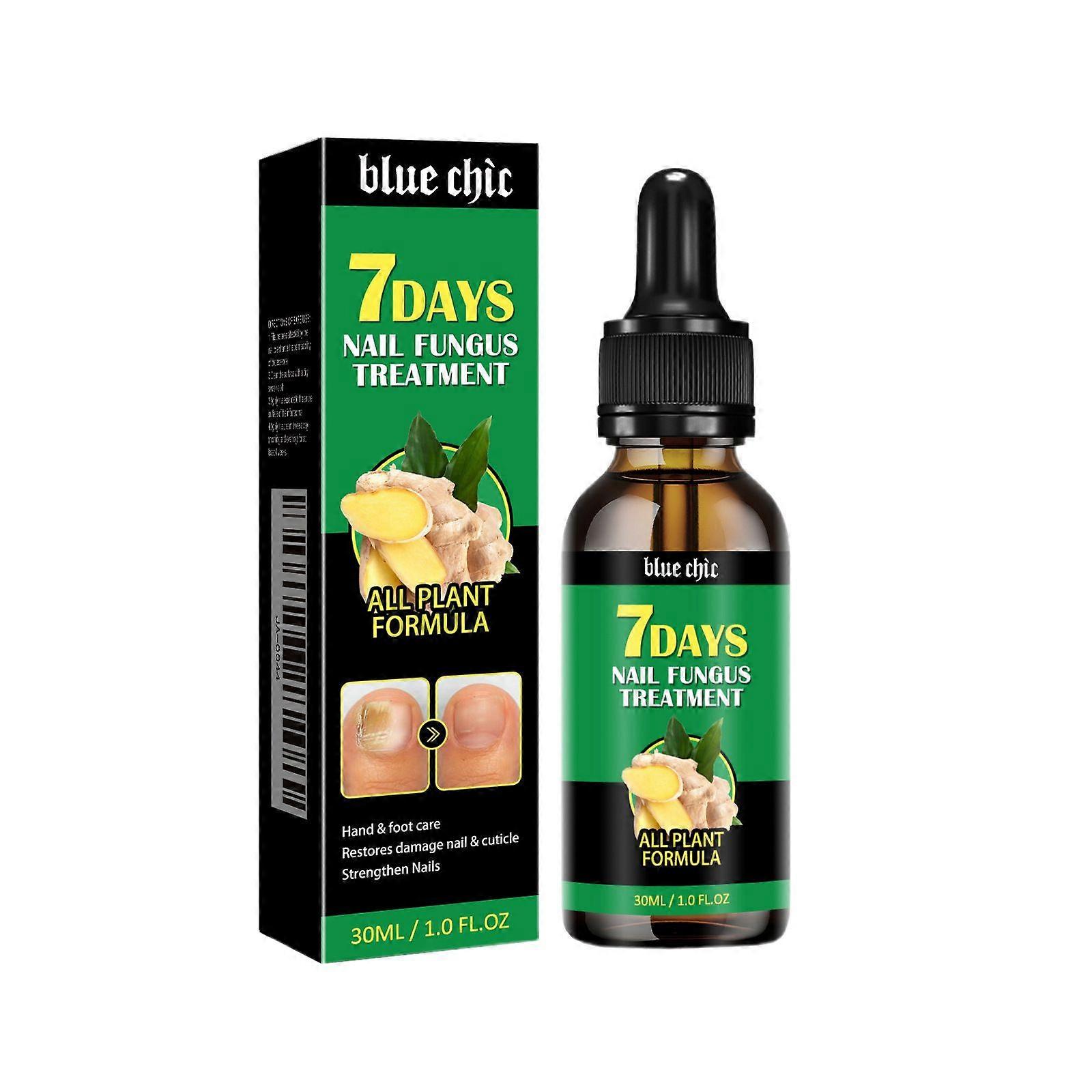 Grzybica paznokci u nóg Leczenie paznokci Extra Strength Ginger Nail Treatmant Nail Support Pielęgnacja paznokci, Leczenie paznokci, Wzmacniacz paznokci Imbirowe serum na wzrost paznokci
