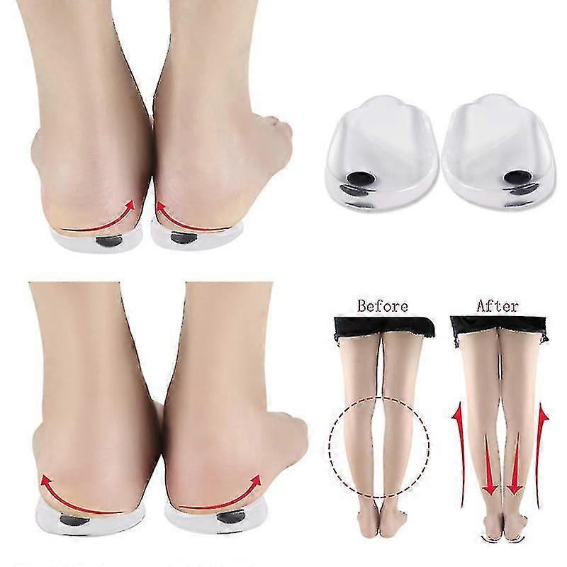 2pcs Semelles intérieures Correction Chaussure Inserts Pads Efficace O / x Type Jambe Jambes Courbières Valgum Redressement