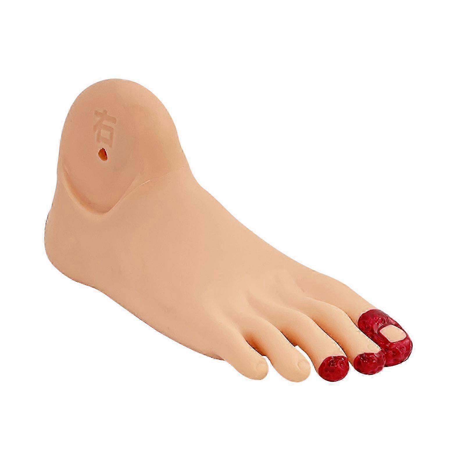 Diabetes Foot Pathology Teaching Model