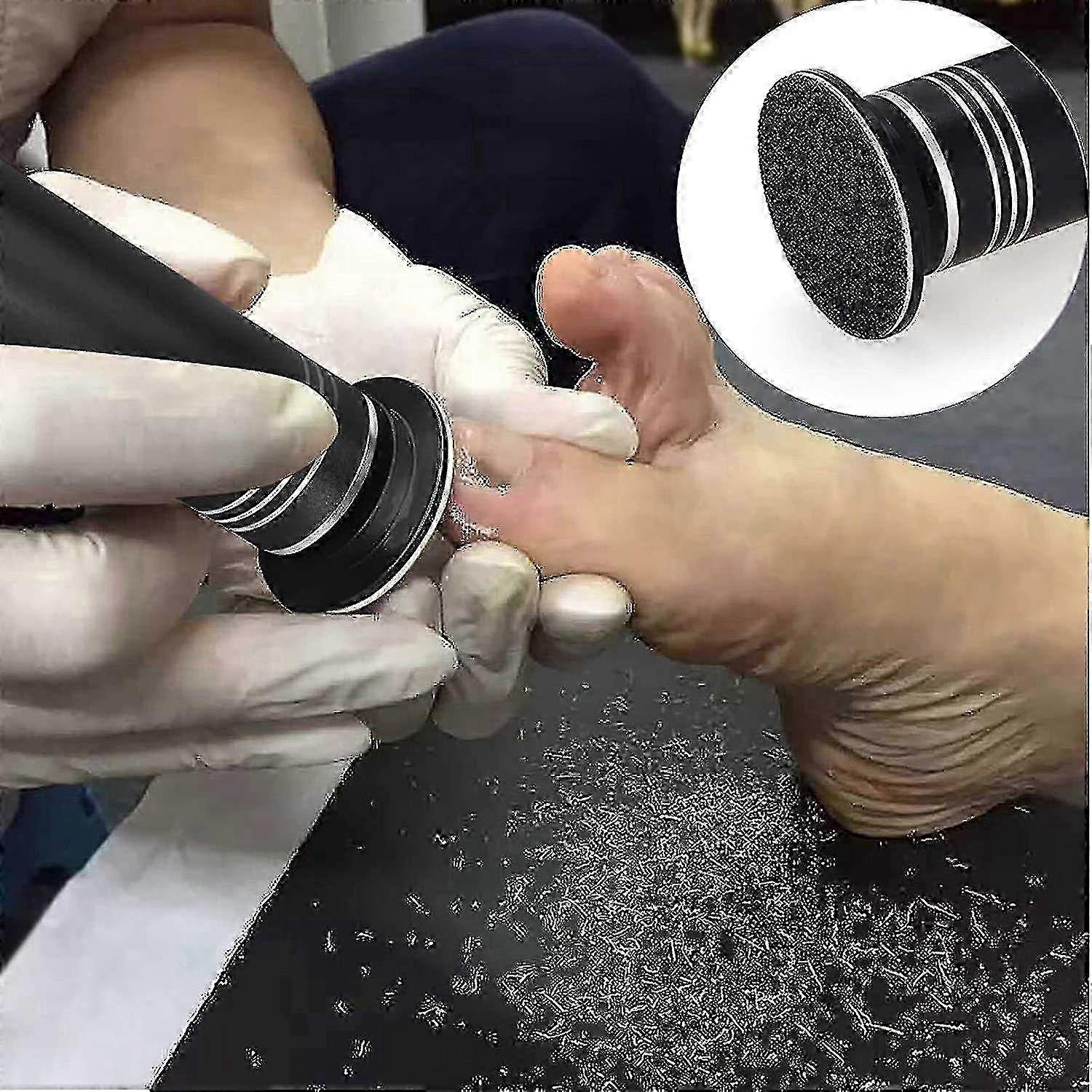 Upgraded Electric Callus Remover (speed Adjustable) With 60pcs Replacement Sandpaper Discs, Professi