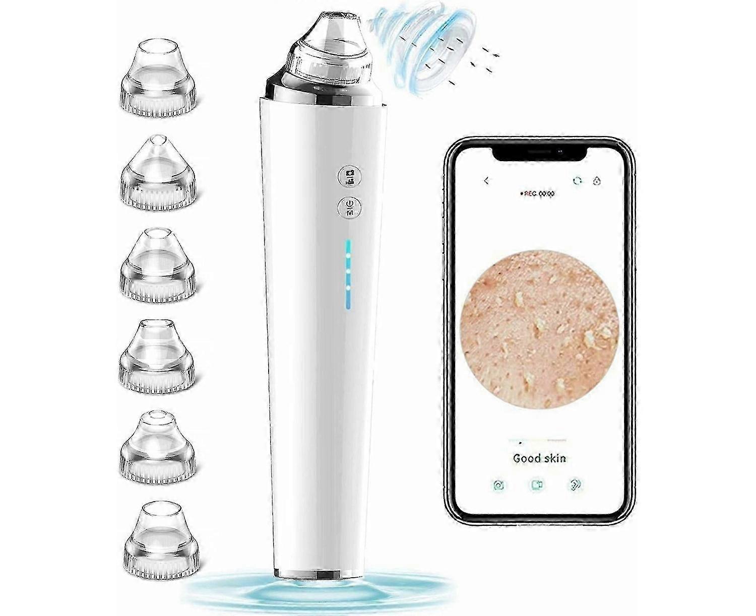 High-Definition Blackhead Remover Vacuum with Camera - Wireless Pore Cleaner for