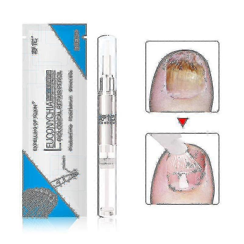 3er Pack 3ml Pilzbehandlung Nagelöl Pen Anti-Pilz Nagelhautentferner