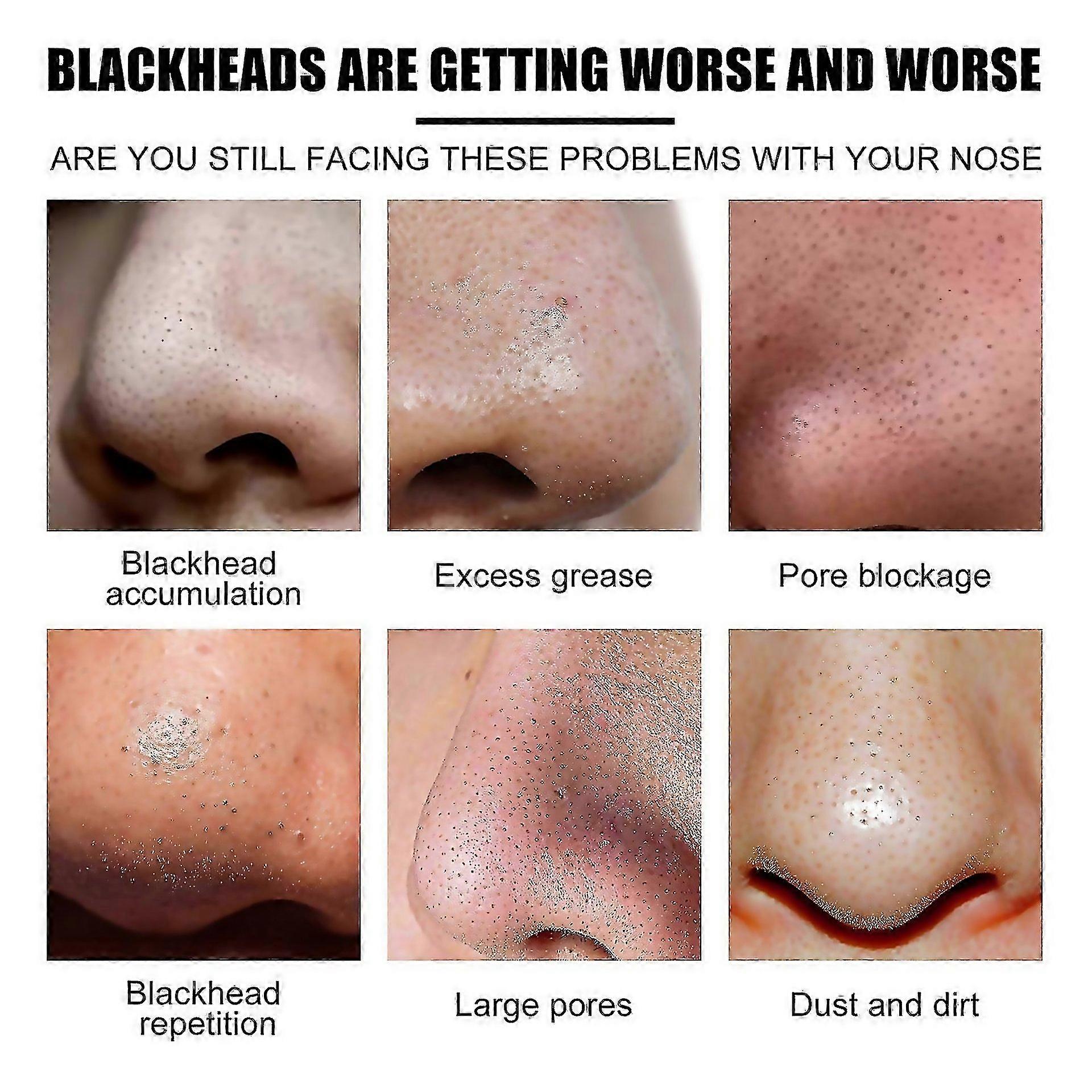 For West Month Blackhead Patch 10pcs