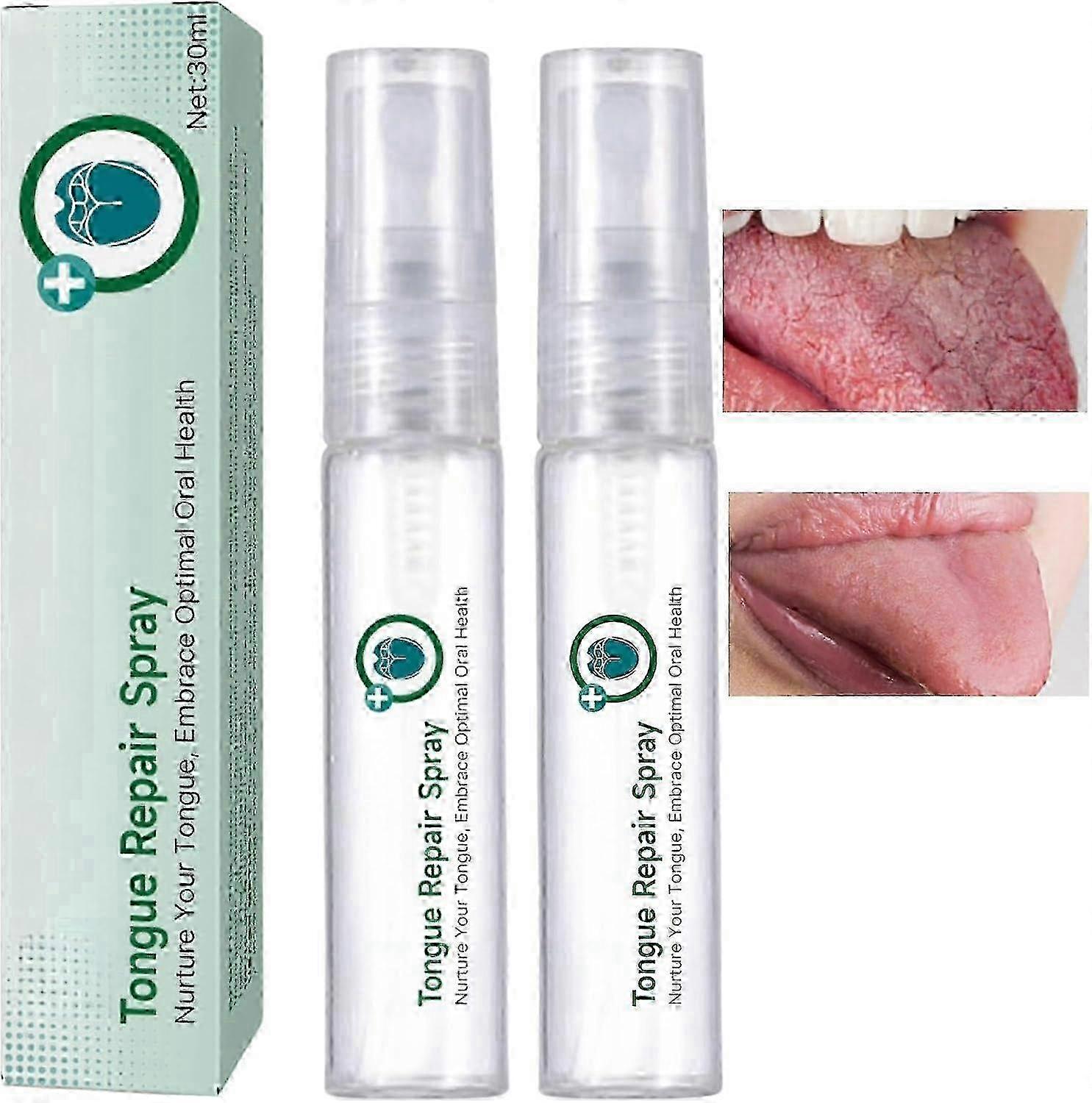 2pcs Tongue Repair Spray, Bad Breath Eliminator, Relieve Dryness and Bad Breath, Cracked Tongue Relief Spray, Breath Freshener Spray
