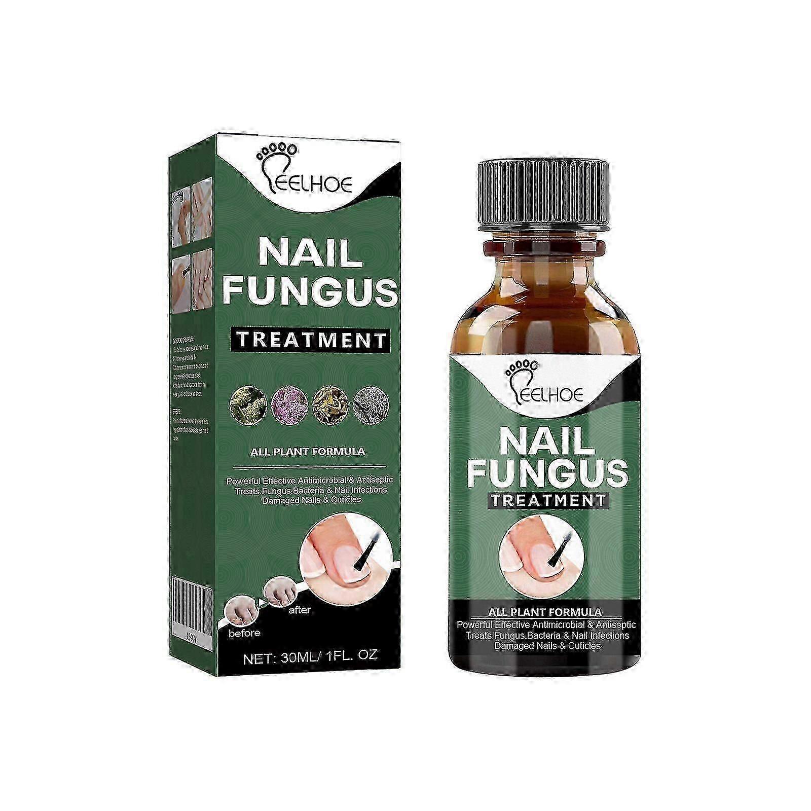 Eelhoe Nail Care Solution Χέρι Και Πόδι Επιφάνεια νυχιών Απαλός Καθαρισμός Ενυδατική Λύση Φροντίδας