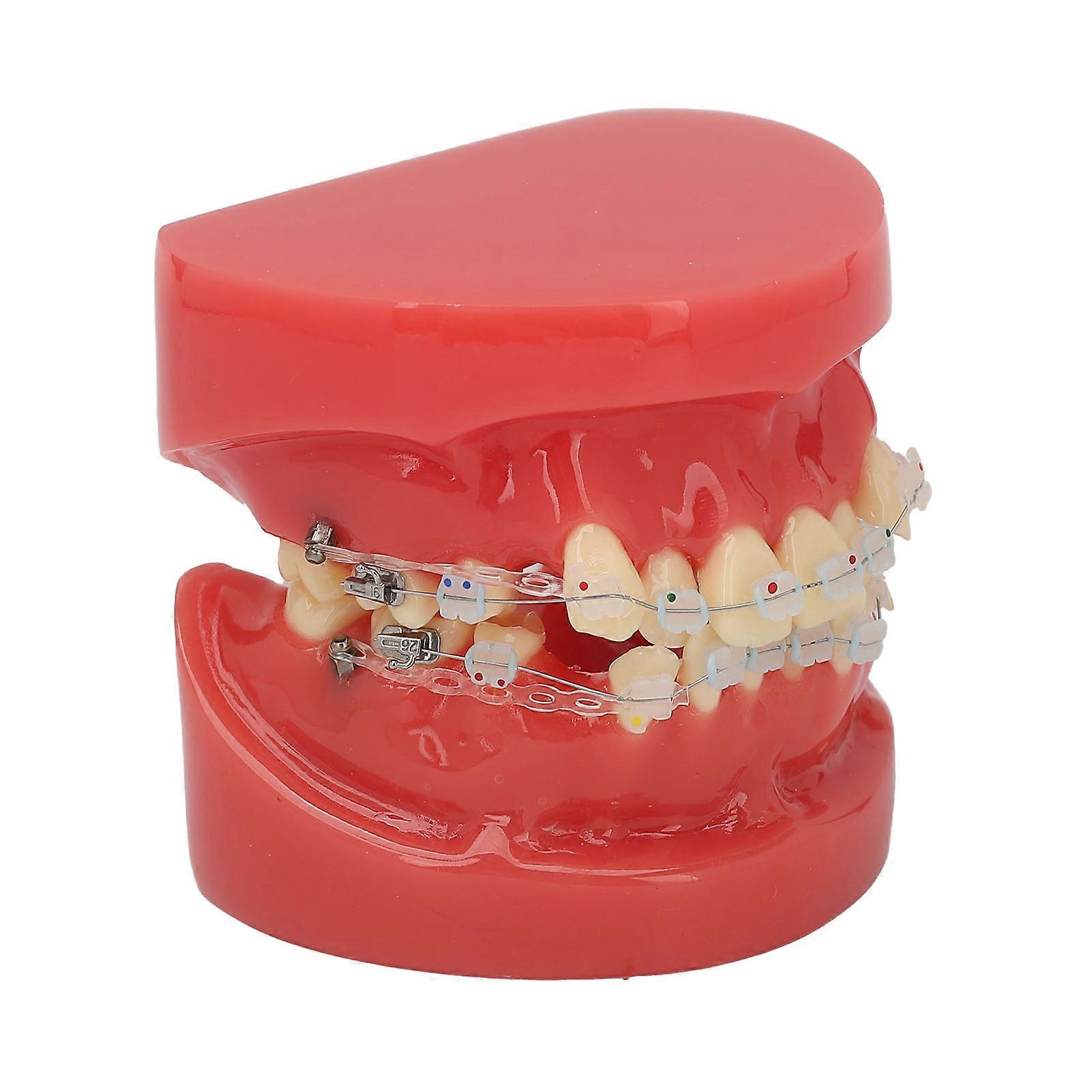 Ceramic Dental Orthodontic Demonstration Model 24 Teeth Model with Wires and Bracket for Teaching Education