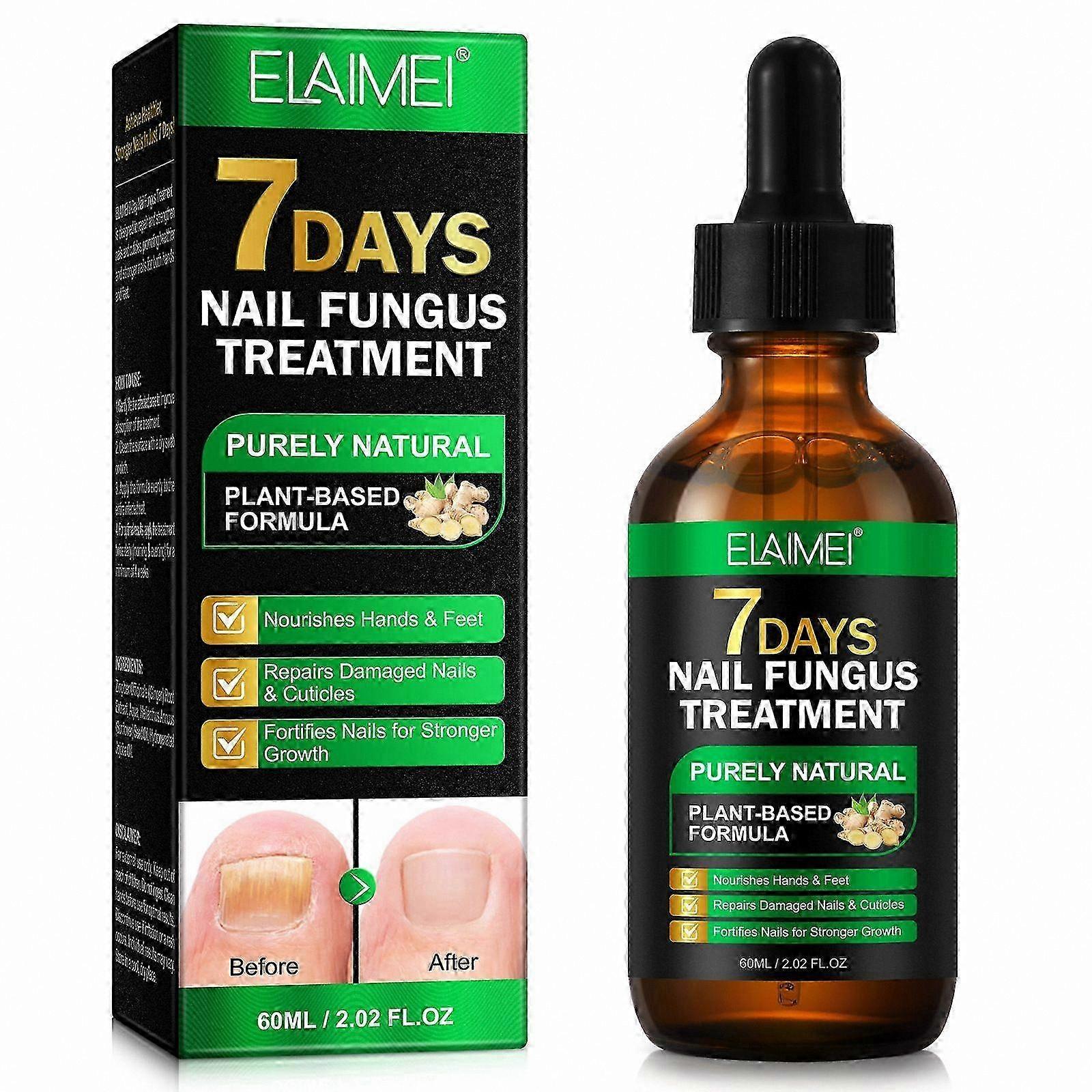 Nail Repair Serum with Ginger, Cuticle Care Oil for Stronger Nails, 7-Day Fungus Treatment Solution