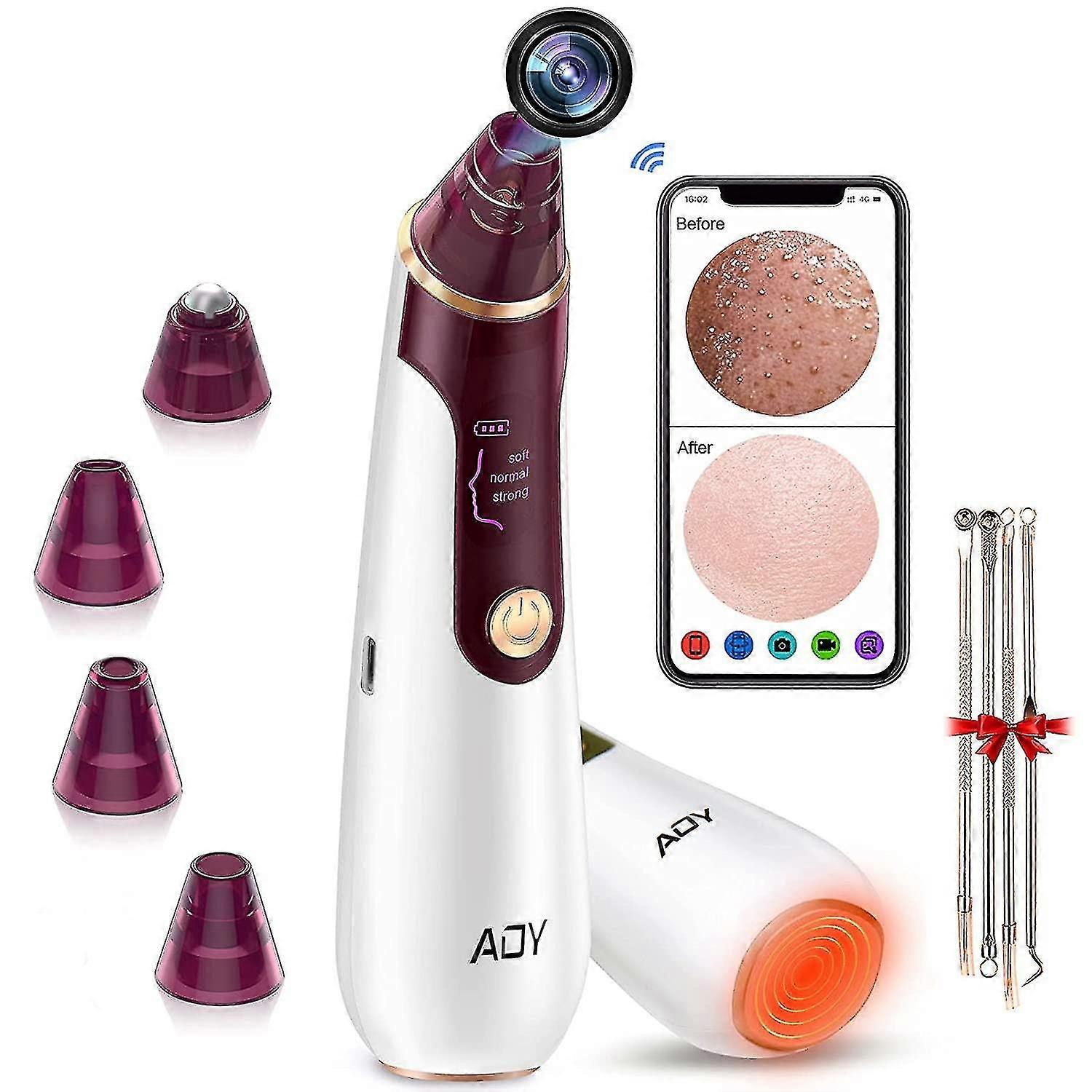 ブラックヘッドリムーバー真空、Camerawifiリアルタイムスキンスクリーン付き毛穴真空、ブラックヘッド毛穴除去