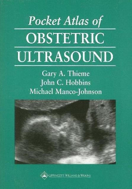 Pocket Atlas Of Obstetric Ultrasound by Michael MancoJohnson Paperback