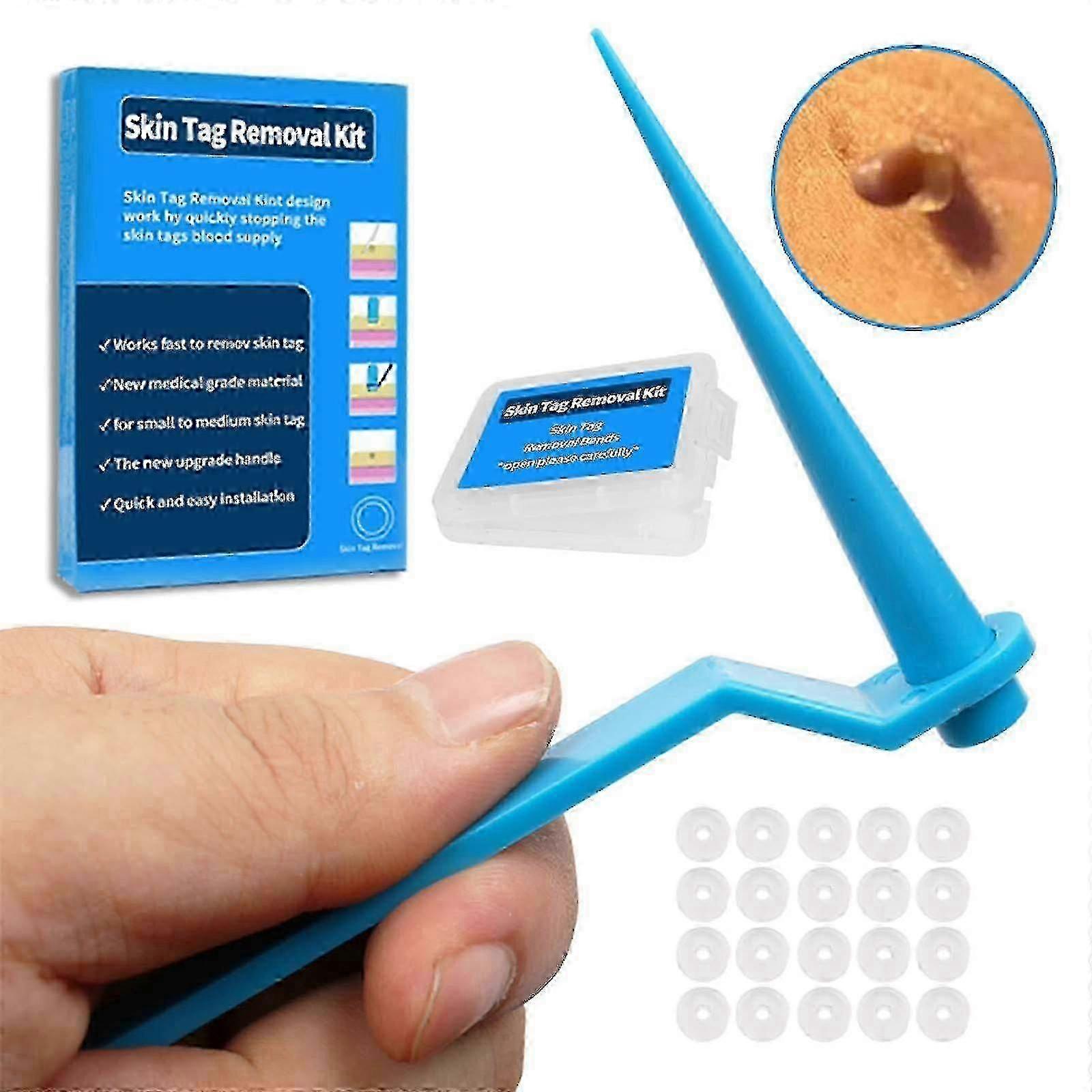 Oem Blue Skin Tag Tool Set Of 20 Rubber Bands Blue