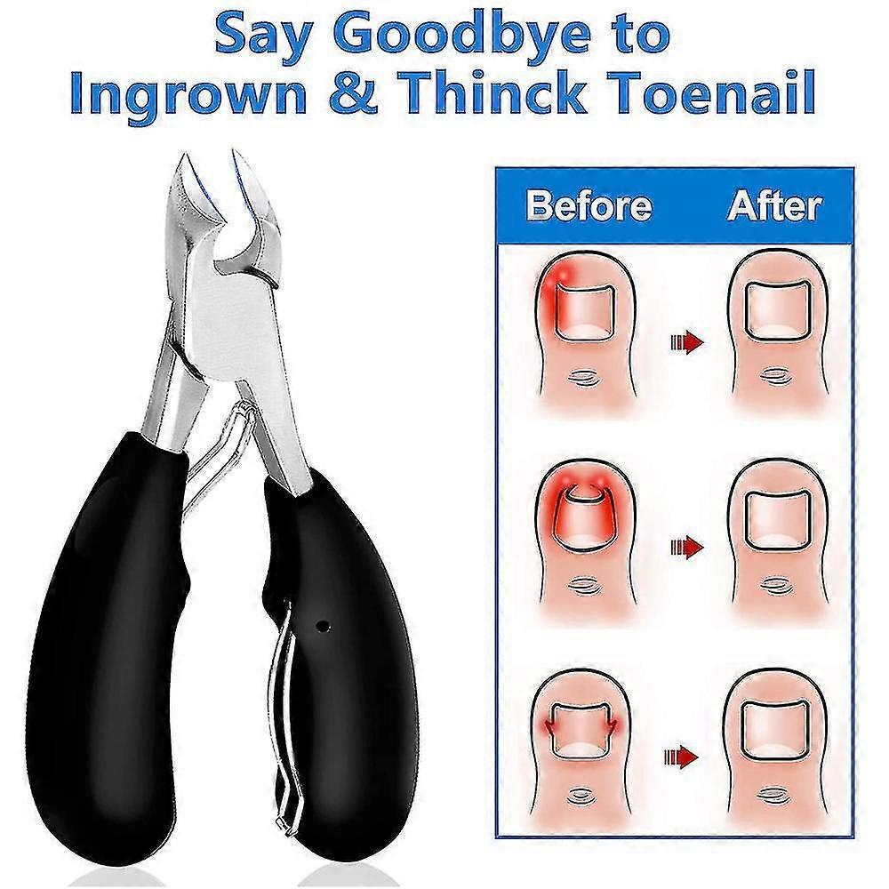 Precision Toenail Clippers For Thick Or Ingrown Toenails