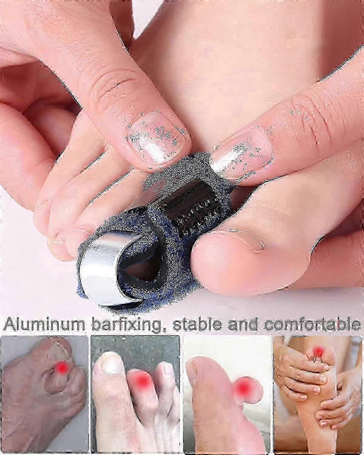 Toe Straightener - Left Toe Splint for Hammer Toe, Fracture, Claw Toe - Breathable Toe Fixation Corrector Strap miao7