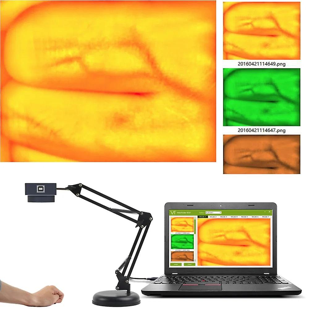 Hd 2mp Adjustable Vein Viewer W/ Infrared Lights & Usb Camera For Adults And Children - Medical Iv Finder Imaging Solution