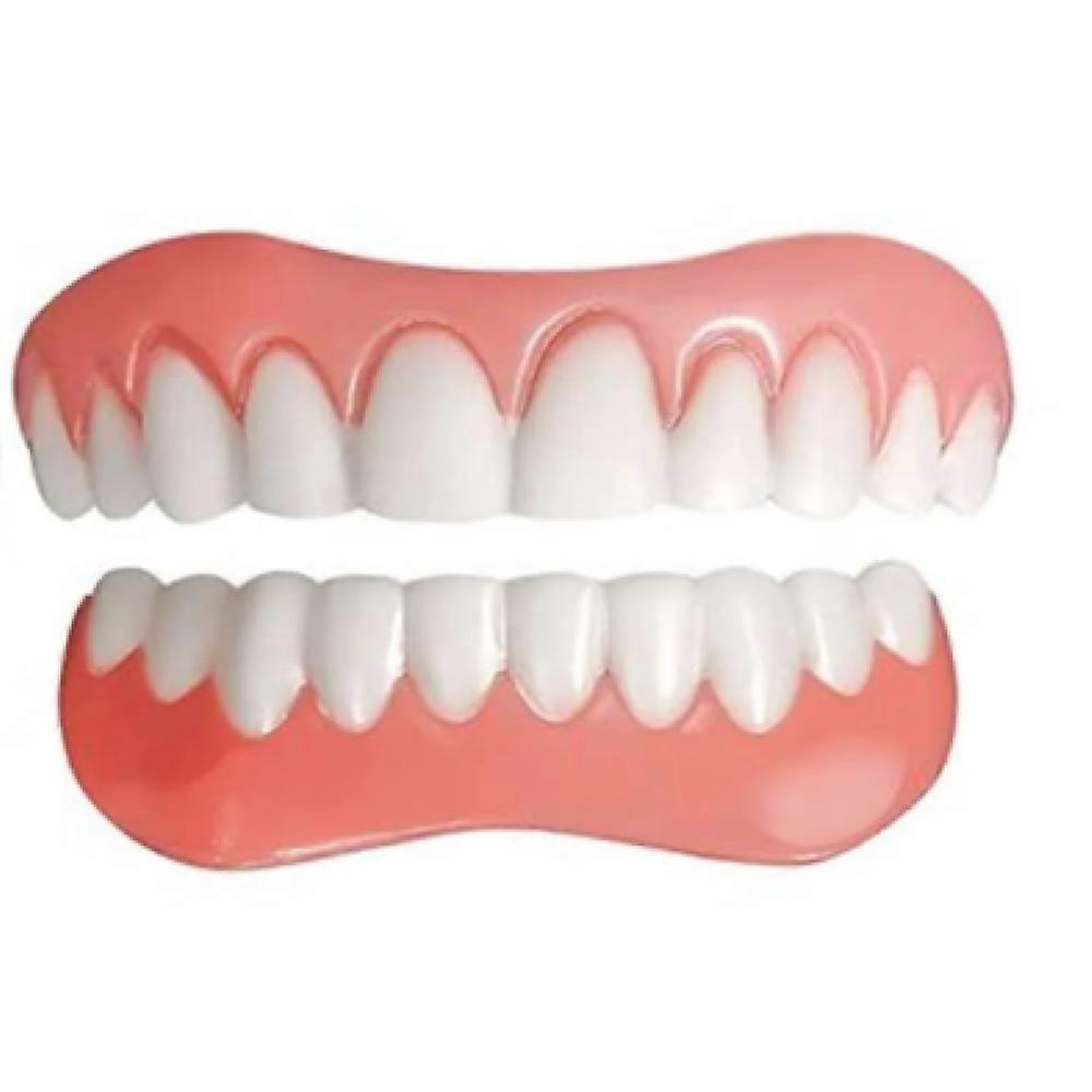 Upper & Lower Dental Veneers, 2 Piece