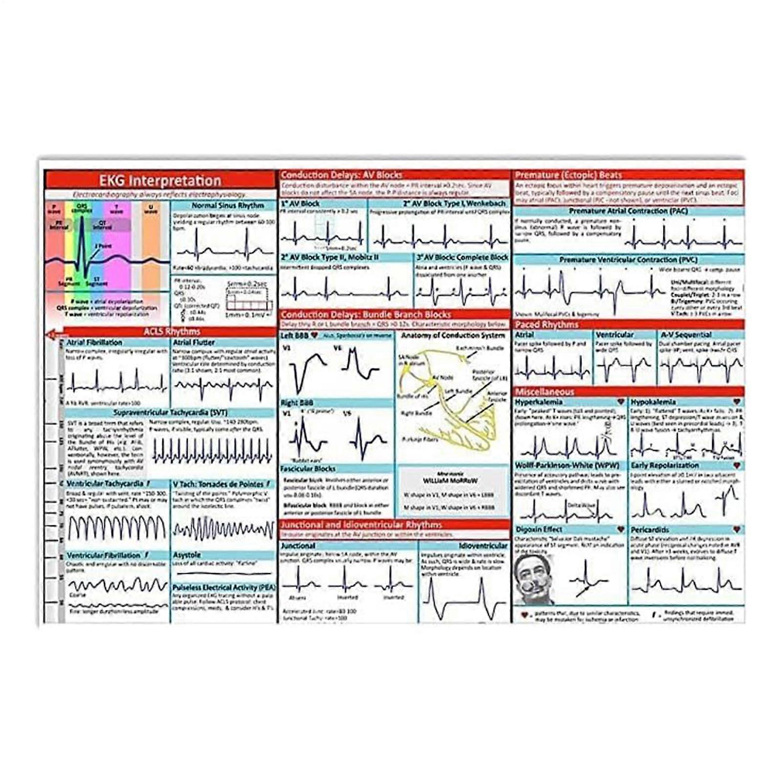 ECG Rhythm Pocket Cards, ECG Pocket Guide, DoubleSided ECG Reference Card